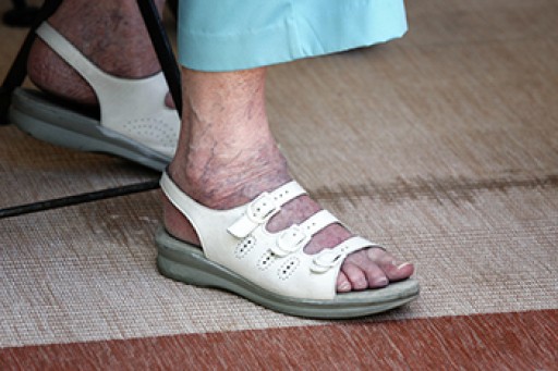 Elderly and their Feet