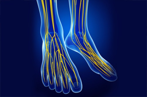 Treating Tarsal Tunnel Syndrome