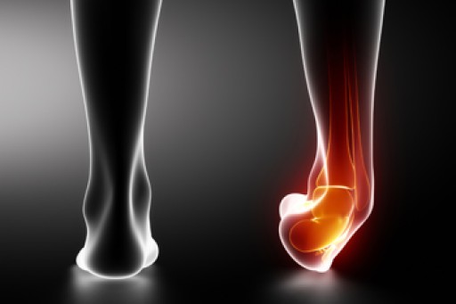All About Broken Ankle