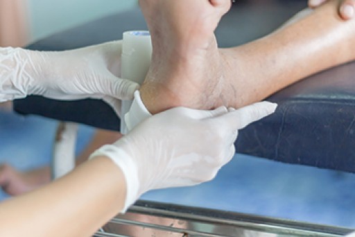 Caring for Heel Pressure Ulcers