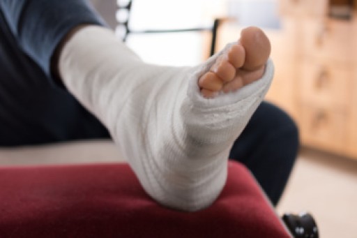 Causes, Symptoms, and Treatment for a Broken Foot